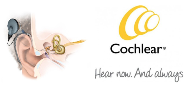 Cochlear Implants